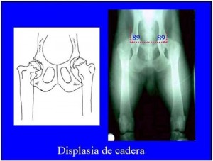 Displasia de cadera en perros