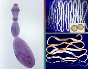 Echinococcus Granulosus. Gusanos planos.