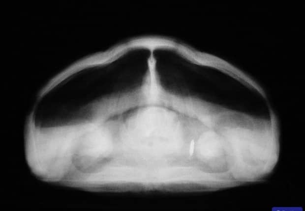 Imagen radiográfica de una tortuga.